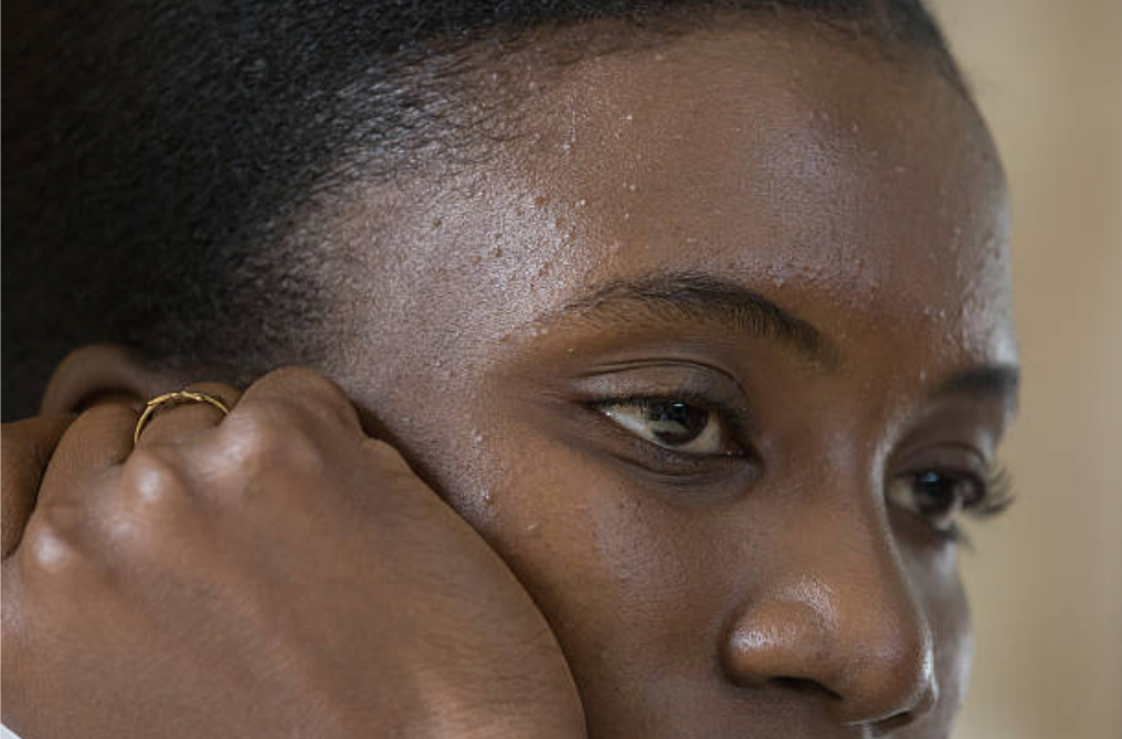 Does Dark Skin Need SPF? The Honest Answer And What Happens If You Skip It