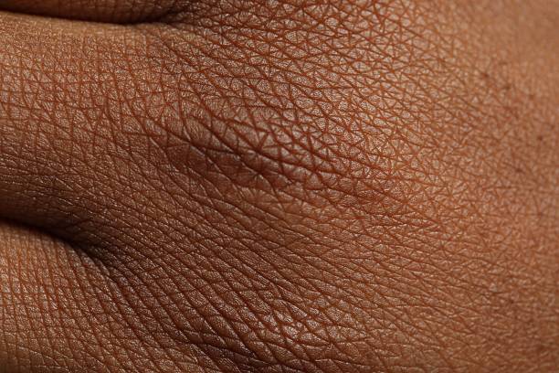 Dry Skin vs Dehydrated Skin: Why This Difference Completely Changes What You Need