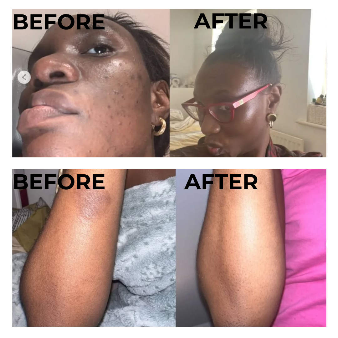 Authentic! African Black Soap