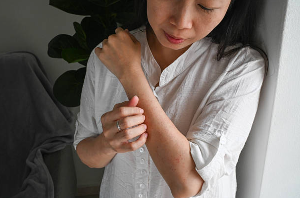 Shea Butter for Eczema: Why African-Sourced Unrefined Shea Works Differently