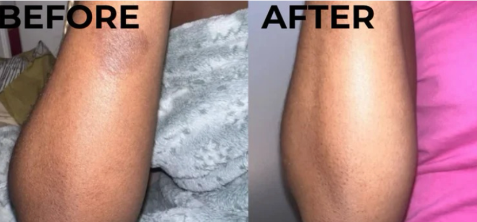 African Black Soap 30-Day Challenge: What to Expect and What the Science Says About the Results