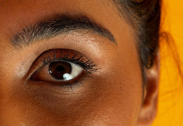 8 Naturals Ways To Reduce Under-Eye Dark Circles, Wrinkles & Fine Lines