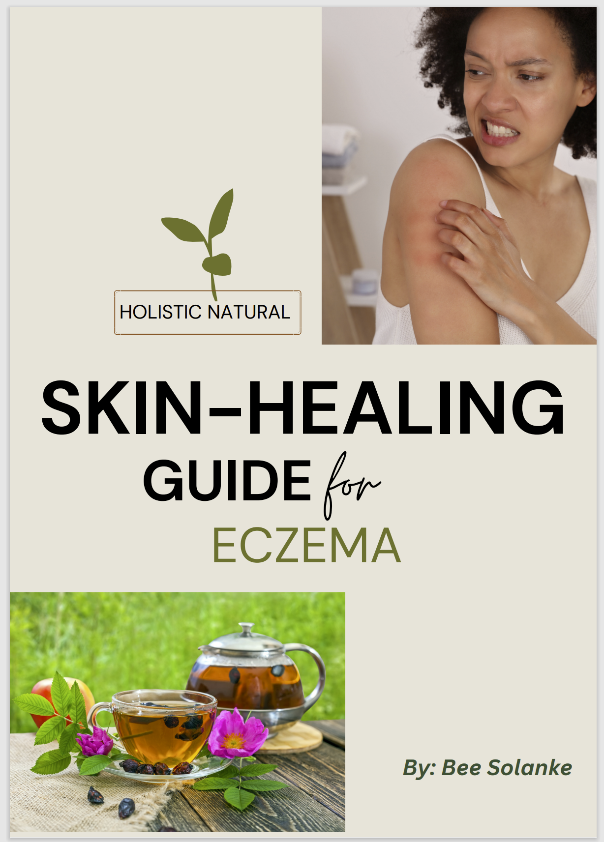 Holistic Natural Skin-Healing Guide for Eczema