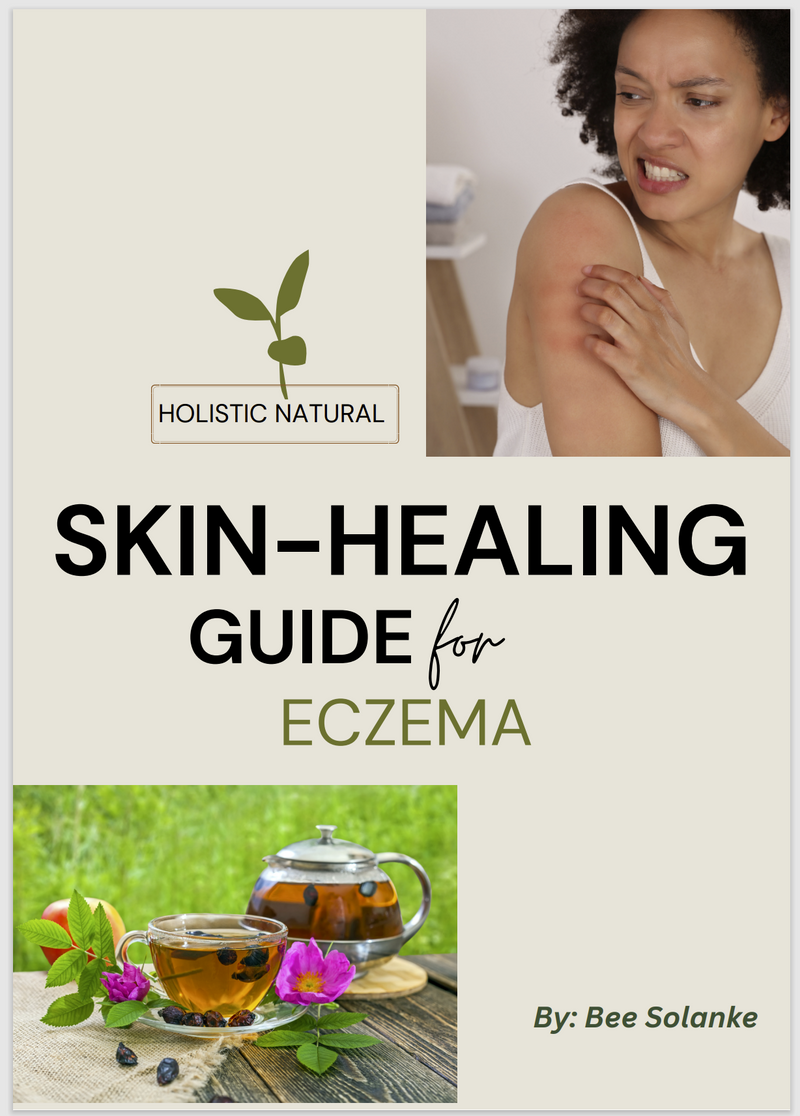 Holistic Natural Skin-Healing Guide for Eczema